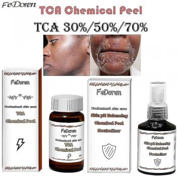 Peeling Ácido para Acné y Cicatrices