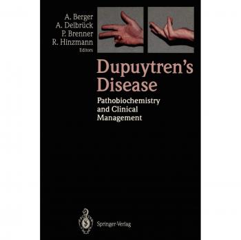 Dupuytren's Disease: Pathobiochemistry and Clinical Management