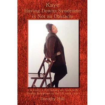 Kaye Having Downs Syndrome is Not an Obstacle: 1 in every 1.000 babies are born with Downs Syndrome in the UK each year