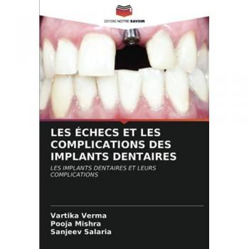 LES ÉCHECS ET LES COMPLICATIONS DES IMPLANTS DENTAIRES: LES IMPLANTS DENTAIRES ET LEURS COMPLICATIONS