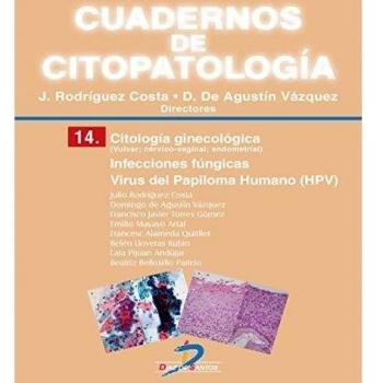 Citología ginecológica: infecciones fúngicas. Virus (Tapa blanda).