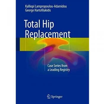 Total Hip Replacement: Case Series from a Leading Registry