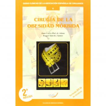 Cirugía de la obesidad mórbida