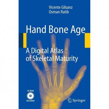 Vitalsource Technologies, Inc. Hand Bone Age