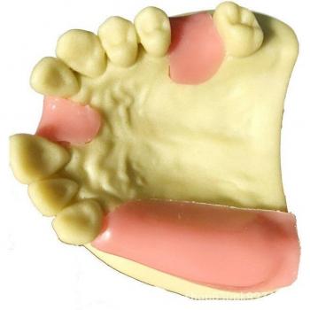 6 Teeth Dental Implant Training Model