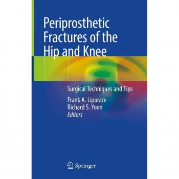 Periprosthetic Fractures of the Hip and Knee