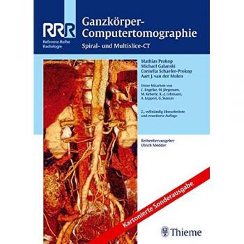 Ganzkörper-Computertomographie: Spiral