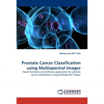 Prostate Cancer Classification using Multispectral Images: Novel Hardware and Software approaches for prostate cancer classification using Multispectral Images