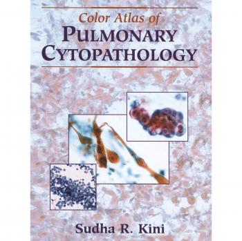 Color Atlas of Pulmonary Cytopathology