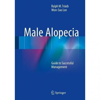 Male Alopecia
