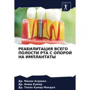 РЕАБИЛИТАЦИЯ ВСЕГО ПОЛОСТИ РТА С ОПОРОЙ НА ИМПЛАНТАТЫ