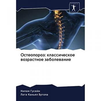 Остеопороз: классическое возрастное заболевание