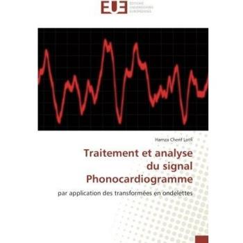 Lotfi, Hamza Cherif: Traitement et analyse du signal Phonocardiogramme