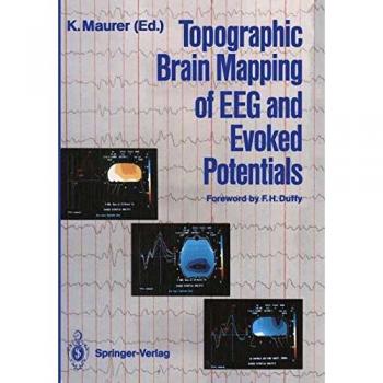Topographic Brain Mapping of EEG and Evoked Potentials