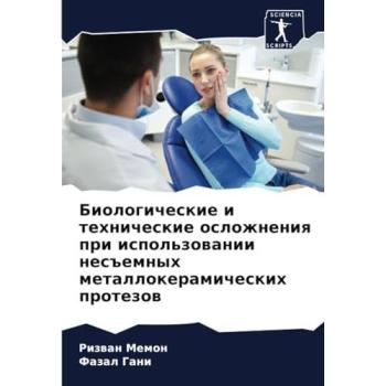 Memon, Rizwan: Biologicheskie i tehnicheskie oslozhneniq pri ispol'zowanii nes#emnyh metallokeramicheskih protezow