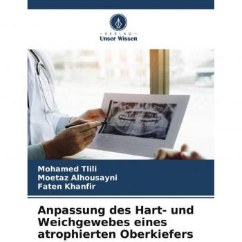 Anpassung des Hart