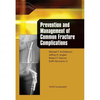 Slack Inc. Prevention and Management of Common Fracture Complications