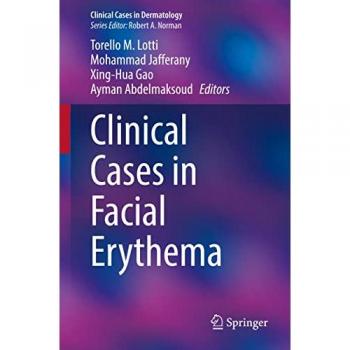 Clinical Cases in Facial Erythema