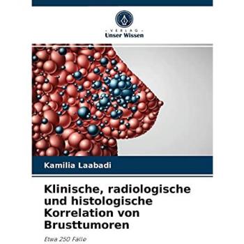 Klinische, radiologische und histologische Korrelation von Brusttumoren: Etwa 250 Fälle
