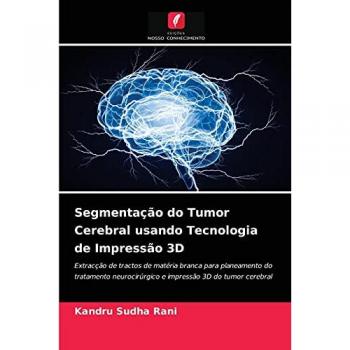 Segmentação do Tumor Cerebral usando Tecnologia de Impressão 3D: Extracção de tractos de matéria branca para planeamento do tratamento neurocirúrgico e impressão 3D do tumor cerebral