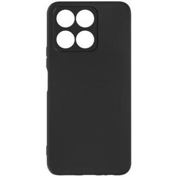 Coque Flexible AVIZAR Honor X6a – Noir, finition mate, anti‑traces
