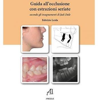 Guida all'occlusione con estrazioni seriate secondo gli insegnamenti di Jack Dale
