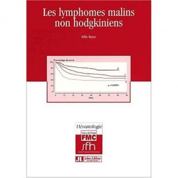 Les lymphomes malins non hodgkiniens (Fmc Hematologie)