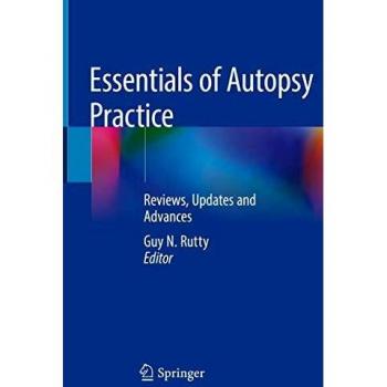 Essentials of Autopsy Practice: Reviews, Updates and Advances