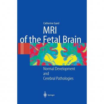MRI of the Fetal Brain