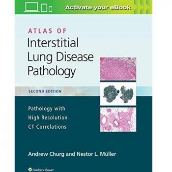Atlas of Interstitial Lung Disease Pathology by Nestor L. Muller