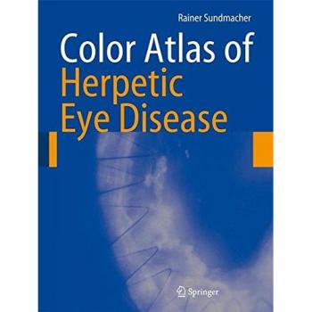 Color Atlas Of Herpetic Eye Disease: A Practical Guide To Clinical Management