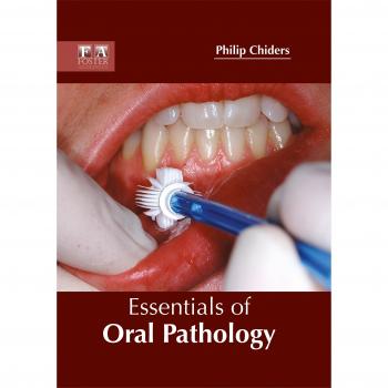 Essentials of Oral Pathology