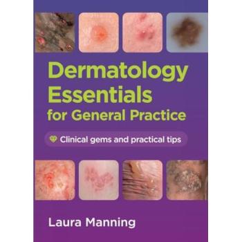 Dermatology Essentials for General Practice : Clinical Gems and Practical Tips