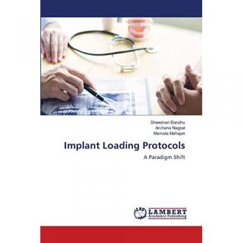 Implant Loading Protocols: A Paradigm Shift