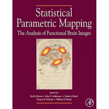 Statistical Parametric Mapping: The Analysis of Functional Brain Images