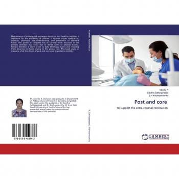 Post and core