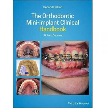 The Orthodontic Miniimplant Clinical Handbook by Richard Consultant Orthodontist for the Peterborough & Stamford Hospitals NHS Foundation Trust Cousley