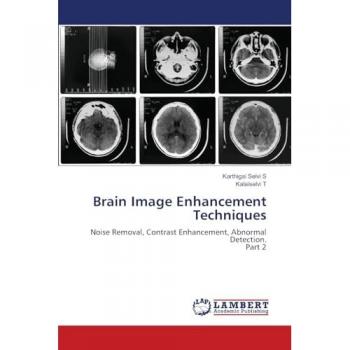 Brain Image Enhancement Techniques: Noise Removal, Contrast Enhancement, Abnormal Detection.Part 2
