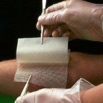 Bactigras Antiseptic Paraffin Gauze 10 x 10 cm Pack of 10