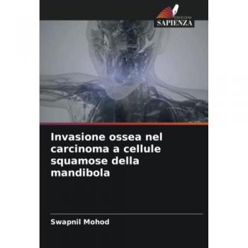 Invasione ossea nel carcinoma a cellule squamose della mandibola