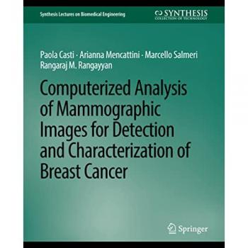 Computerized Analysis of Mammographic Images for Detection and Characterization of Breast Cancer
