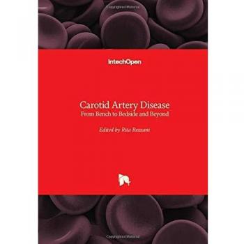 Carotid Artery Disease