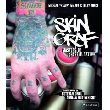 Skin Graf