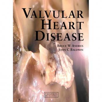 Vitalsource Technologies, Inc. Valvular Heart Disease