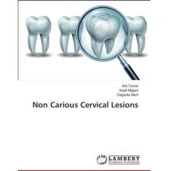 Non Carious Cervical Lesions