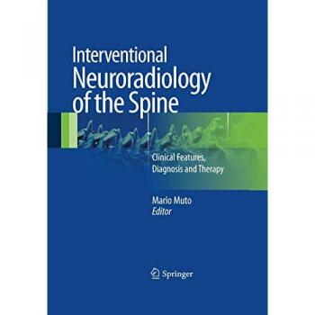 Interventional Neuroradiology of the Spine