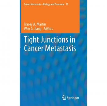 Tight Junctions in Cancer Metastasis