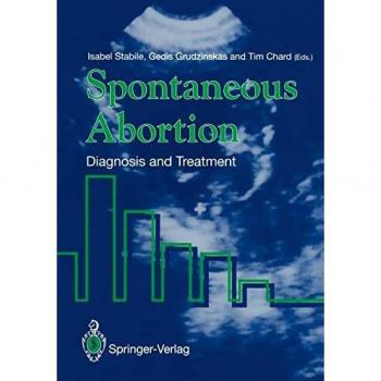 Spontaneous Abortion