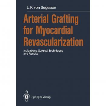 Arterial Grafting for Myocardial Revascularization: Indications, Surgical Techniques and Results