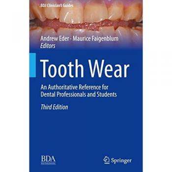 Tooth Wear